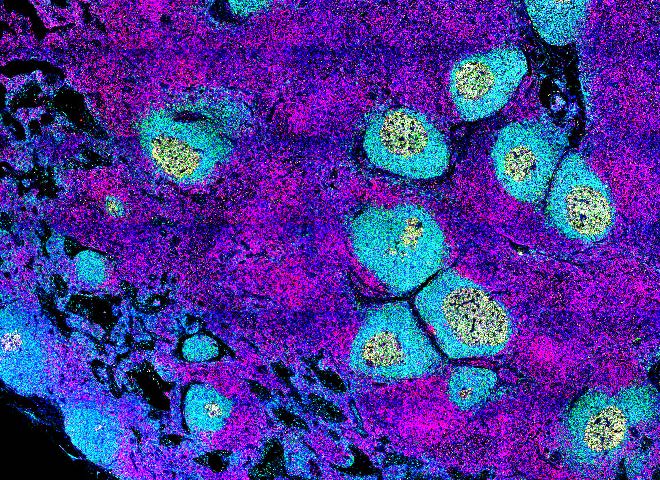 Germinal centers in a normal lymph node